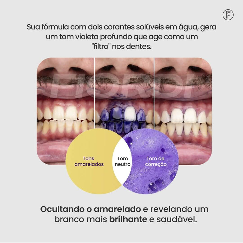 Clareador Dentário - Sérum V34™